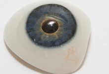 Восстановление дефектов глаза