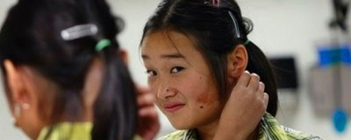 Анапластологи из Голливуда создали для девочки новое ухо