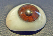 Глазное протезирование и восстановление глаза