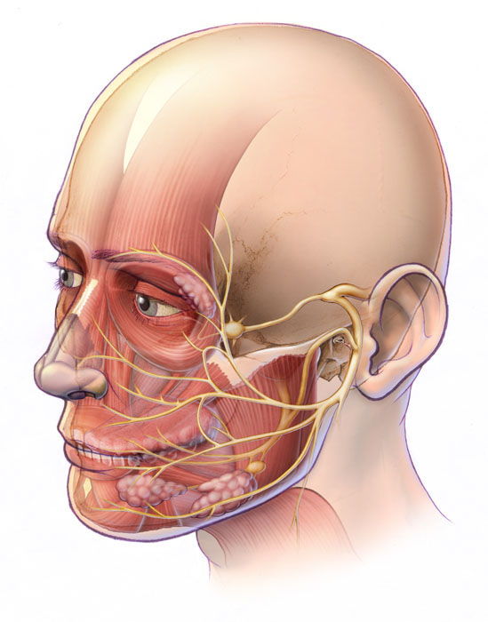 Лицевые эктопротезы после опухоли головы и шеи