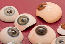 Восстановление частей лица: орбиты глаза, уха