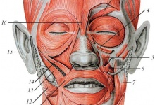 Лицевые дефекты - протезирование при синдроме Гольденхара
