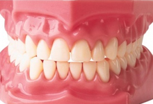 Дефект челюсти - протезирование