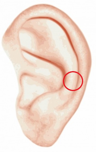 Восстановление уха, ушной раковины