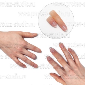 Протезы пальцев