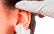 Восстановление уха, исправление дефекта ушной раковины